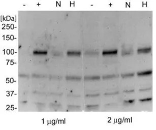 HIF2 alpha antibody [ep190b]