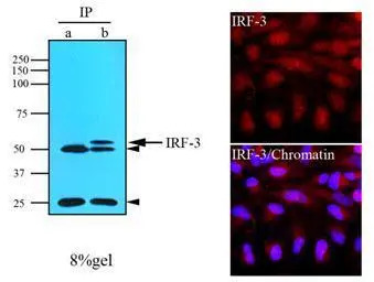 IRF3 antibody [3F10]