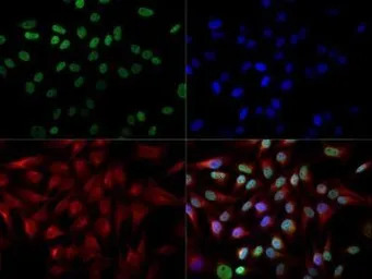 CITED2 antibody [JA22]
