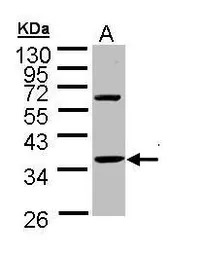 Troponin T1 (slow) skeletal mu