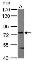 Menin antibody [N1C1]