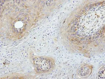 ASK1 antibody [C2C3-2], C-term