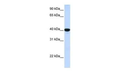 G6PC antibody, N-term
