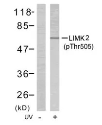 LIM kinase 2 (phospho Thr505) 