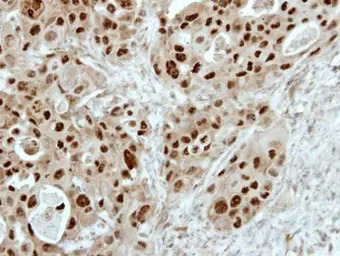E2F6 antibody