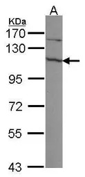 EXOSC10 antibody