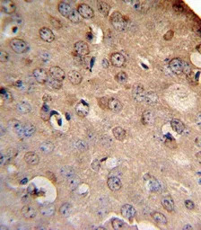 NCX1 antibody, Internal