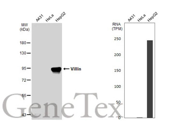 Villin antibody