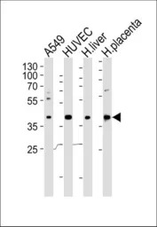 OLR1 / LOX-1 antibody, Interna