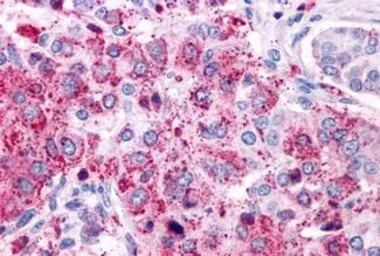 VIP receptor 1 antibody