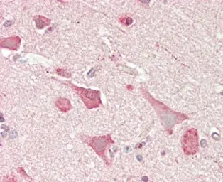 n-Myc antibody, C-term