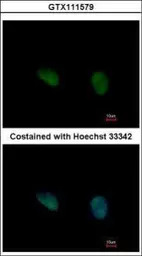 PHKG2 antibody [N2C3]