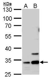 Annexin V antibody