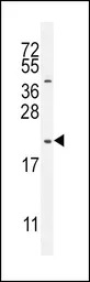 GHRH antibody, N-term