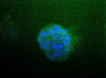 Sodium/Potassium ATPase alpha 