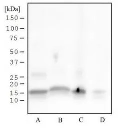 Histone H3S28ph (phospho Ser28