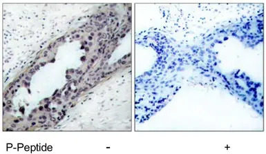 PTEN (phospho Ser380/Thr382/Th