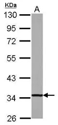 DECR1 antibody
