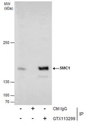 SMC1A antibody