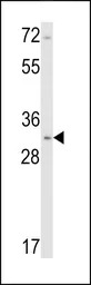 Calponin 1 antibody, N-term