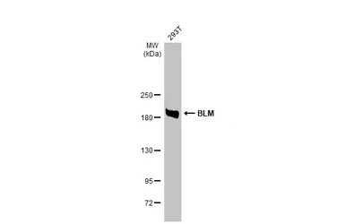 BLM antibody [N1N3]