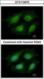 Annexin VIII antibody [N1C2]