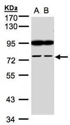 FSD2 antibody [N1N2], N-term