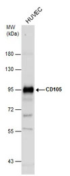 CD105 antibody [N3C3]