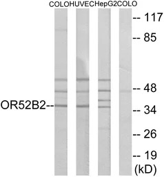 OR52B2 antibody