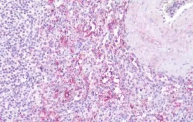 Leukotriene B4 Receptor antibo