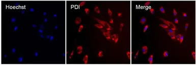 PDI antibody [RL90]