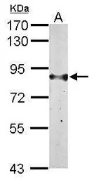 H6PD antibody [N2N3]