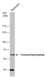 Tyrosine Hydroxylase antibody