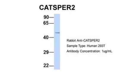 CATSPER2 antibody, N-term