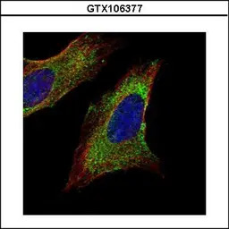 TOM1L1 antibody [C3], C-term