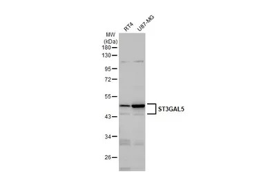 ST3GAL5 antibody [N3C3]