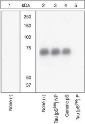 Tau (phospho Ser396) antibody