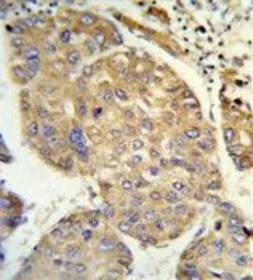 PHACTR2 antibody, N-term