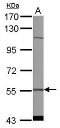 CDADC1 antibody [C1C3]