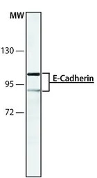 E-Cadherin antibody [DECMA-1]