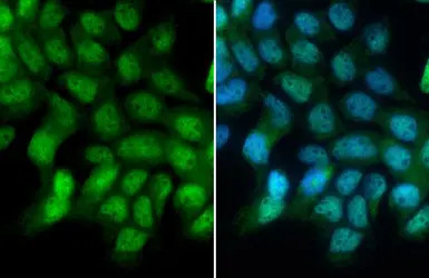 Glucocorticoid Receptor antibo