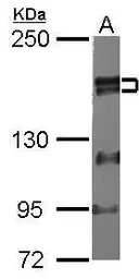 ZNF198 antibody