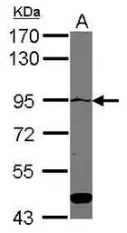 ATP2C1 antibody [C1C2], Intern