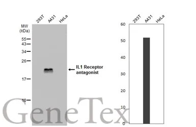IL1 Receptor antagonist antibo
