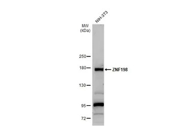 ZNF198 antibody