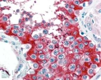 G6PD (aa 308 - 320) antibody, 