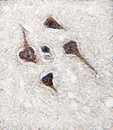 CaMKII alpha antibody, C-term