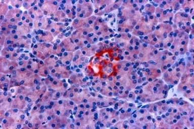 Somatostatin receptor antibody