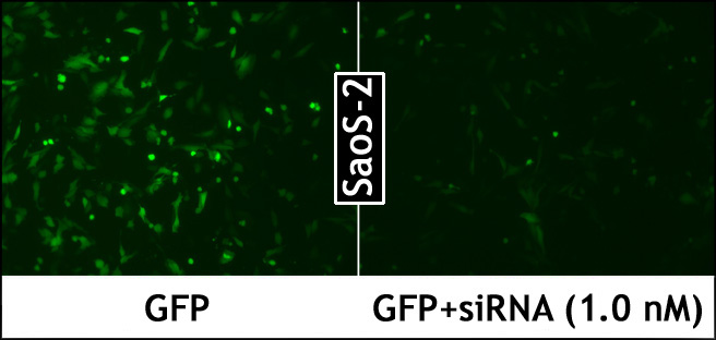 LipoJet™体外DNA转染试剂盒