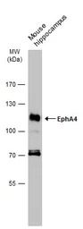 EphA4 antibody [N3C2], Interna